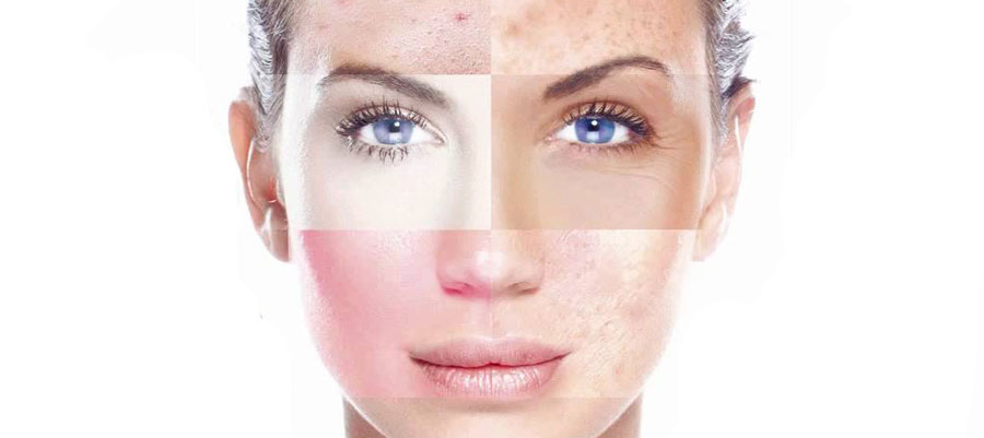 نکات ضروری برای پوست در سرما